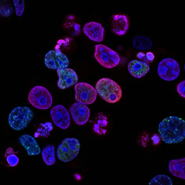 Purple cells photo