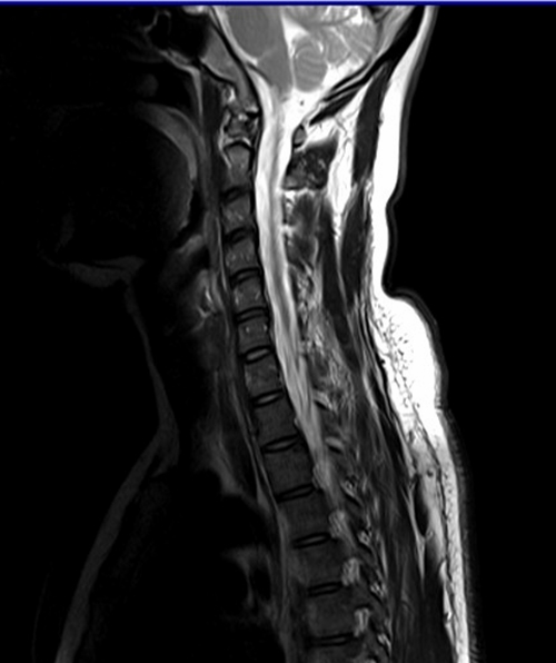 T1 Vs T2 Mri Understanding The Differences Inscmagazine