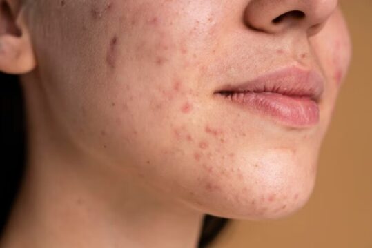 Diverse Skin Issues Based On Individual Skin