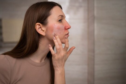 Sensitivity And Redness
